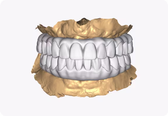 EviSmart CAD