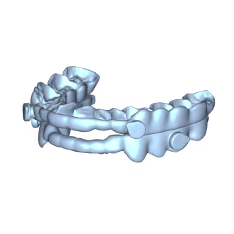 Orthodontic Appliances