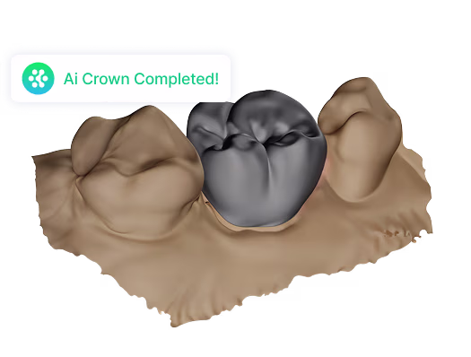 Ai Crowns 2