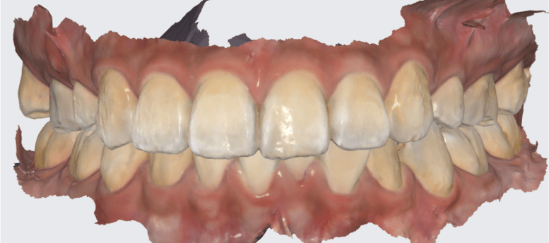 closed bite scan.png
